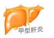 甲肝