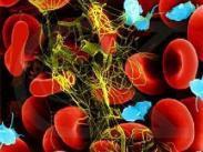 過敏性急性小管間質性腎炎