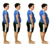 全身脂肪代謝障礙