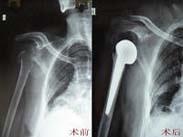 病態竇房結綜合征